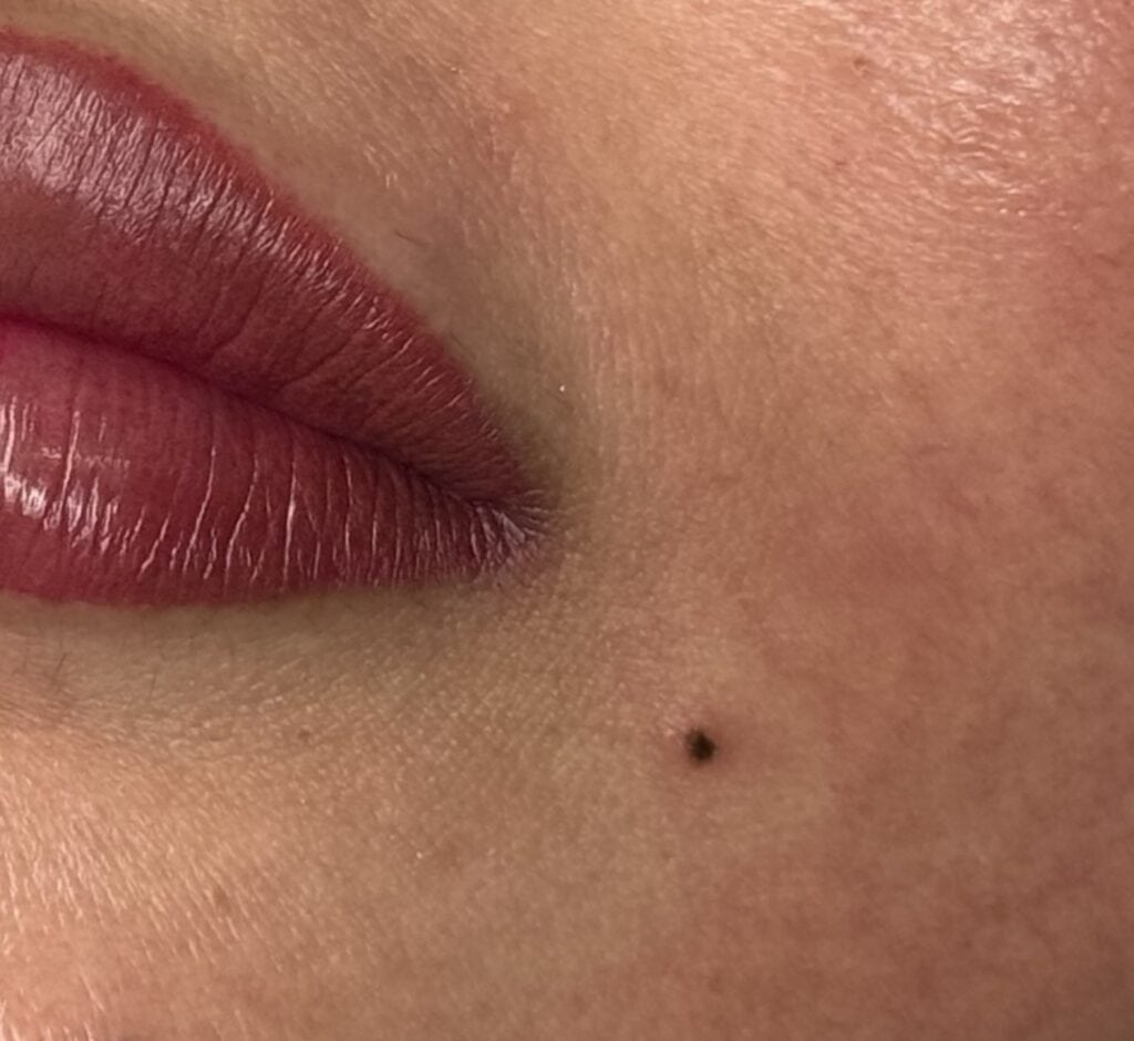 Freckle & Beauty Mark Tattoo at Belle Ame Skin and Beauty Lounge in Vancouver