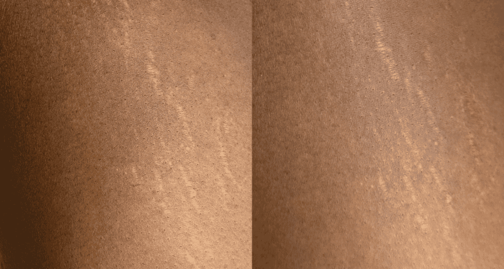 Inkless camouflage stretch mark and scar treatment at Belle Ame Skin and Beauty Lounge in Vancouver