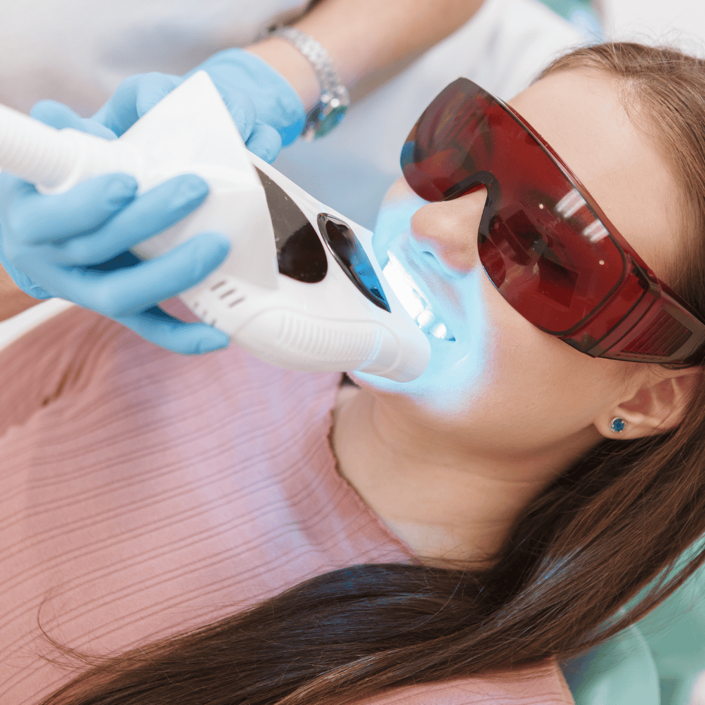 Teeth whitening in vancouver at Belle Ame Skin and Beauty Lounge in Vancouver