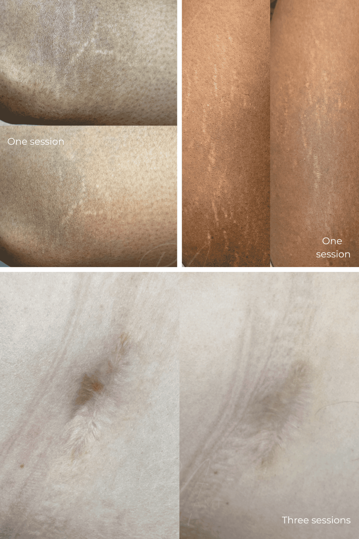 Online inkless camouflage training by Belle Ame Skin and Beauty Lounge