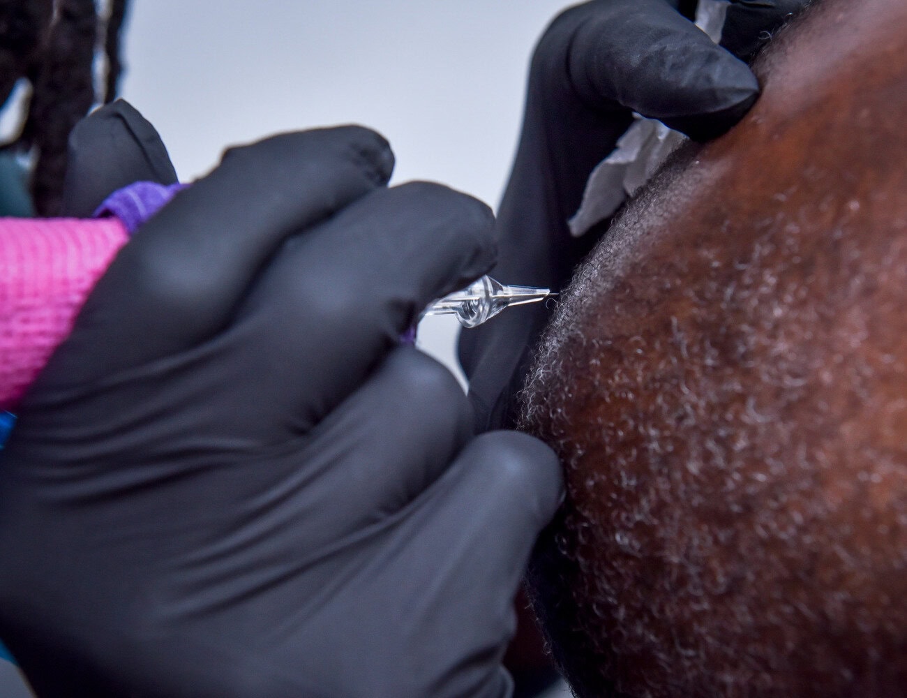 Scalp micropigmentation SMP vancouver Belle ame skin and beauty lounge about