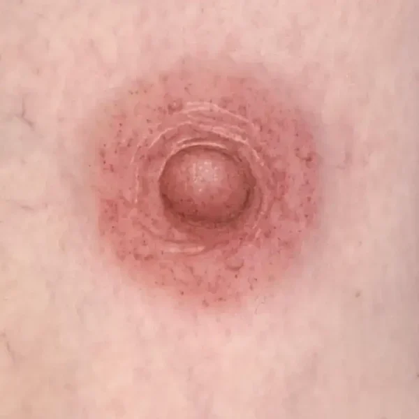 3D Areola & Nipple Restoration Tattoo
