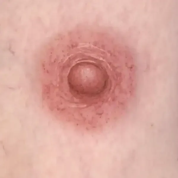 3D Areola & Nipple Restoration Tattoo