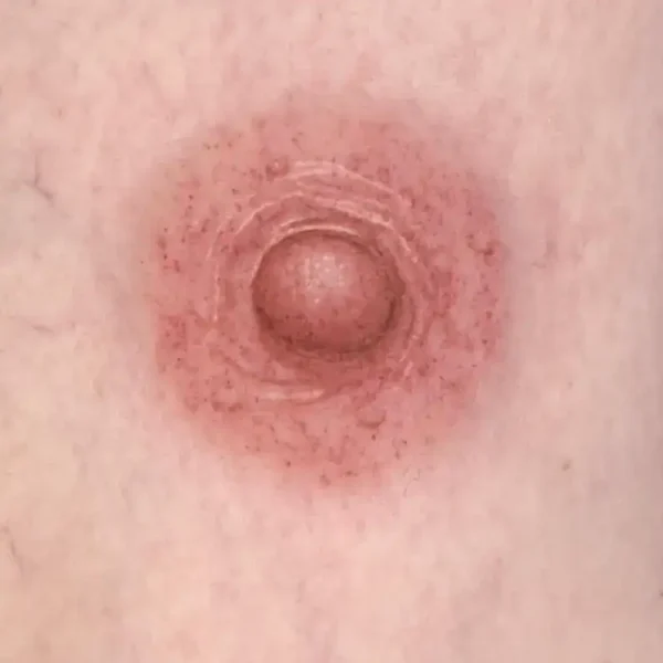 Areola 3d nipple tattoos Vancouver