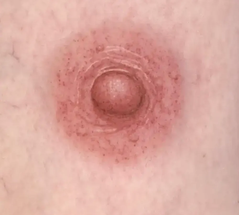 Areola 3d nipple tattoos Vancouver