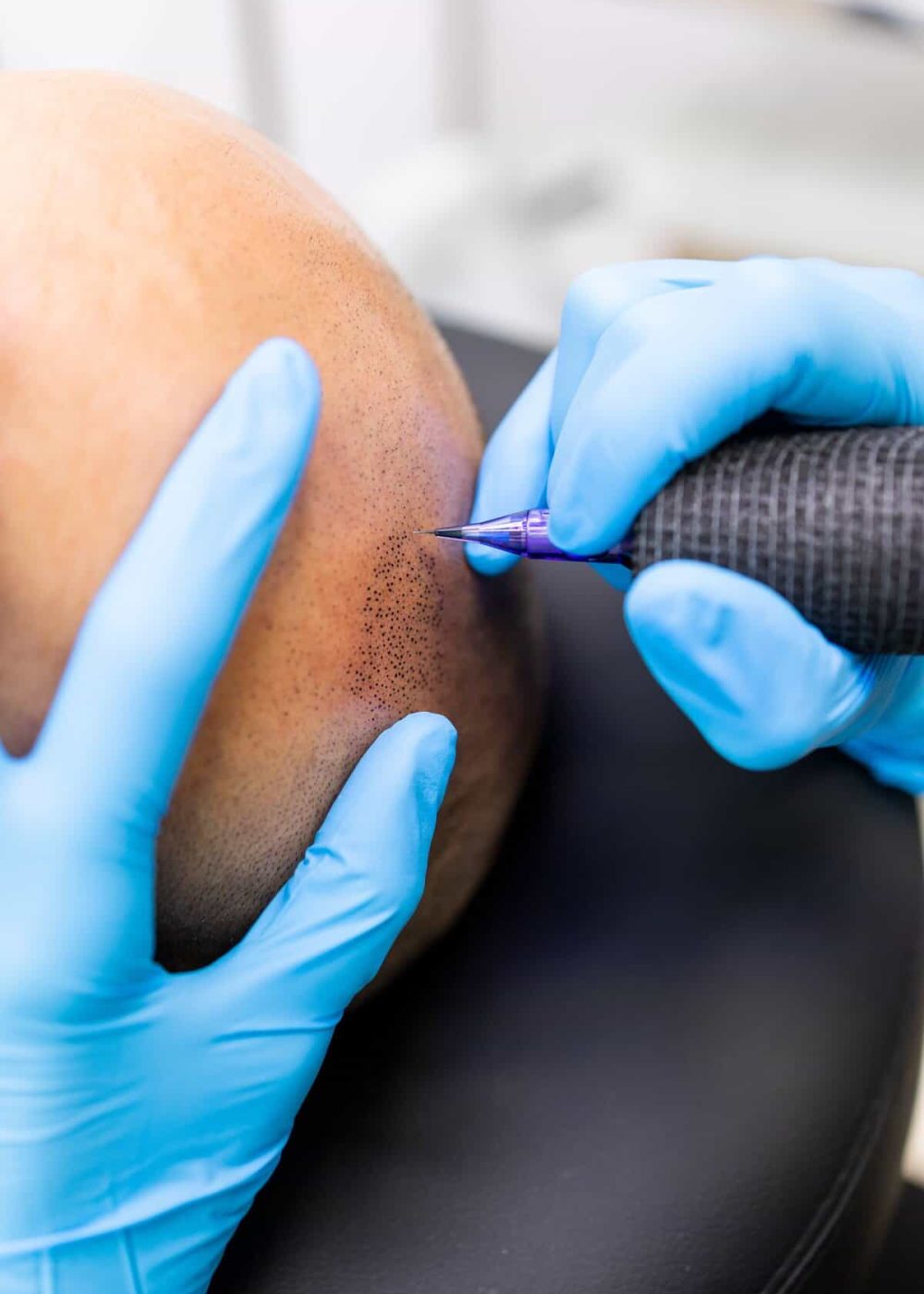 Scalp micropigmentation SMP vancouver Belle ame skin and beauty lounge about